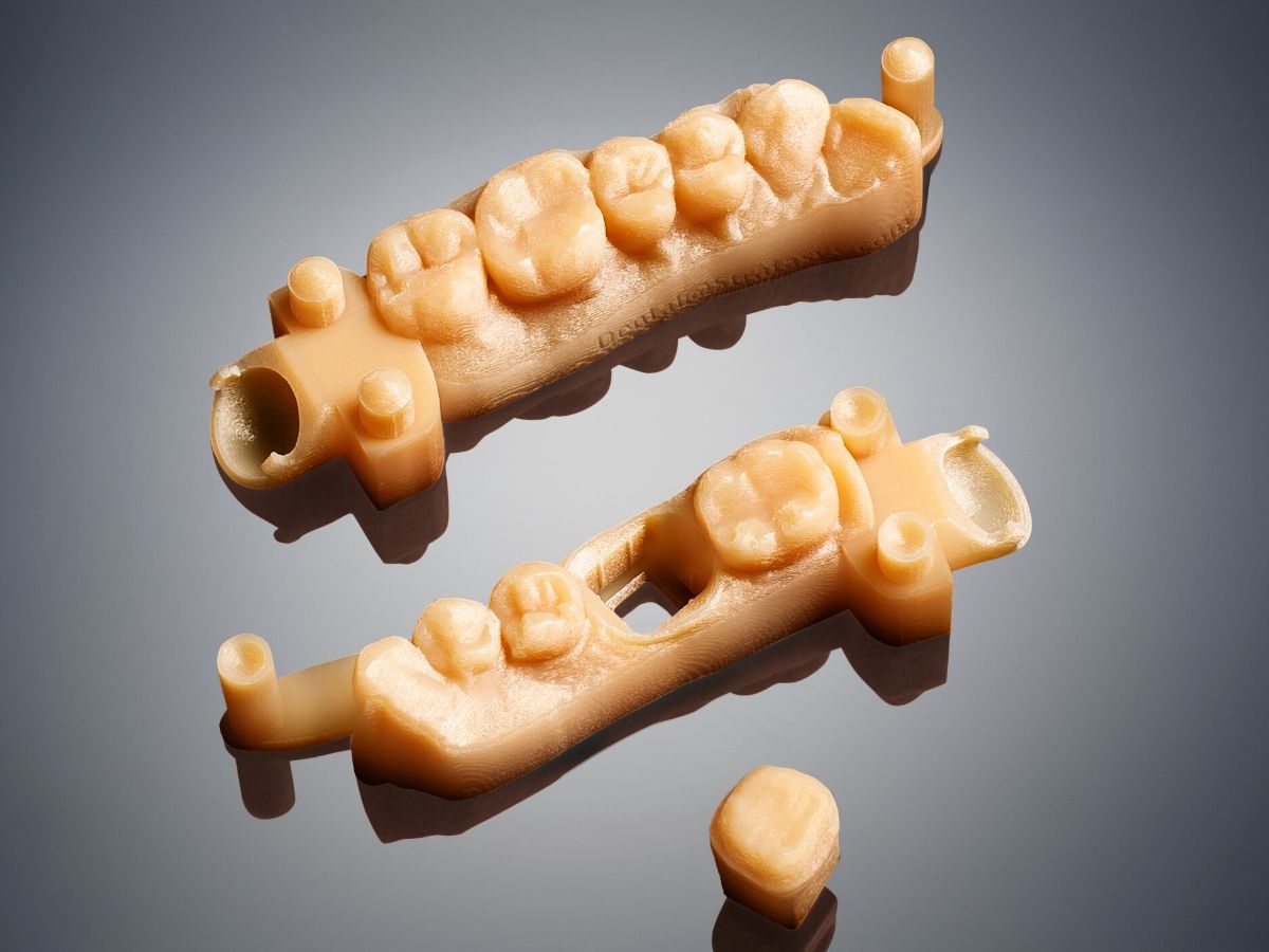 3d-blog_Crown-and-bridge-stone-models-produced-on-Objet_4-3.jpg
